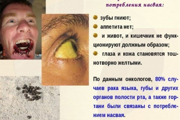 Кракен это даркнет